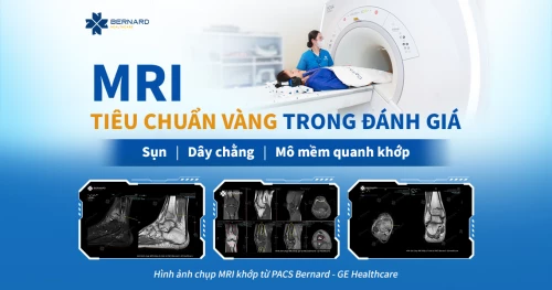MRI – “Tiêu chuẩn vàng” trong đánh giá sụn, dây chằng và mô mềm quanh khớp